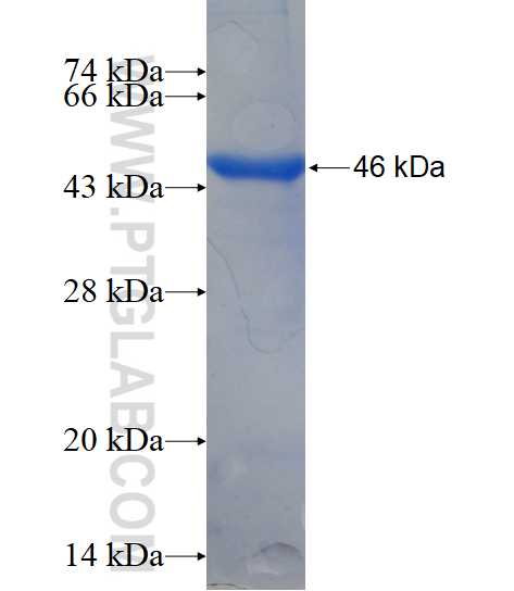 ZSCAN20 fusion protein Ag14999 SDS-PAGE