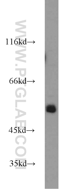 Western Blot (WB) analysis of HepG2 cells using ZSCAN21 Polyclonal antibody (23164-1-AP)