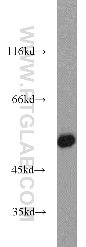 Western Blot (WB) analysis of HEK-293 cells using ZSCAN21 Polyclonal antibody (23164-1-AP)