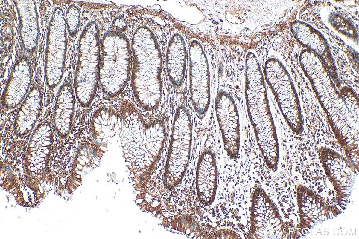 Immunohistochemistry (IHC) staining of human colon tissue using ZSCAN29 Polyclonal antibody (21630-1-AP)
