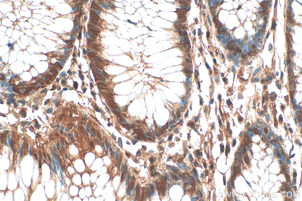 Immunohistochemistry (IHC) staining of human colon tissue using ZSCAN29 Polyclonal antibody (21630-1-AP)