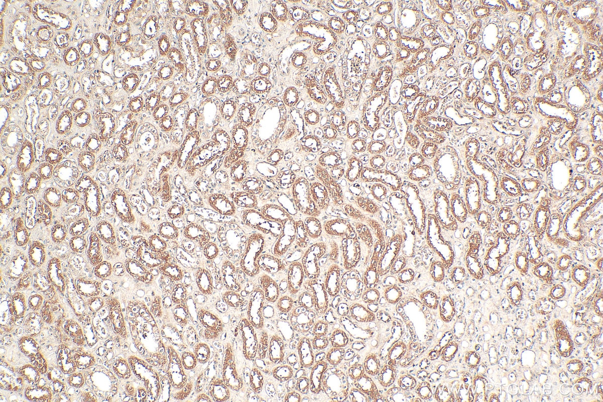Immunohistochemical analysis of paraffin-embedded human kidney tissue slide using 21630-1-AP (ZSCAN29 antibody) at dilution of 1:200 (under 10x lens). Heat mediated antigen retrieval with Tris-EDTA buffer (pH 9.0). Immunohistochemistry (IHC) staining of human kidney tissue using ZSCAN29 Polyclonal antibody (21630-1-AP)