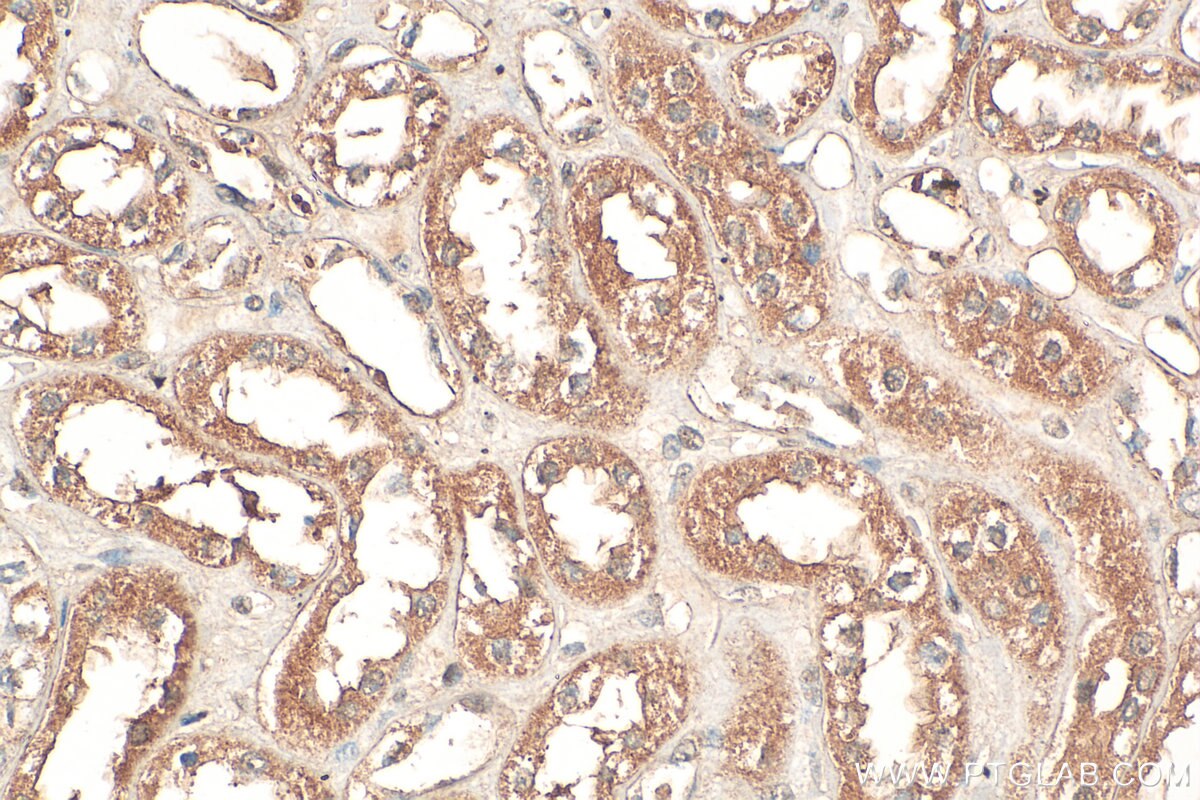 Immunohistochemical analysis of paraffin-embedded human kidney tissue slide using 21630-1-AP (ZSCAN29 antibody) at dilution of 1:200 (under 40x lens). Heat mediated antigen retrieval with Tris-EDTA buffer (pH 9.0). Immunohistochemistry (IHC) staining of human kidney tissue using ZSCAN29 Polyclonal antibody (21630-1-AP)