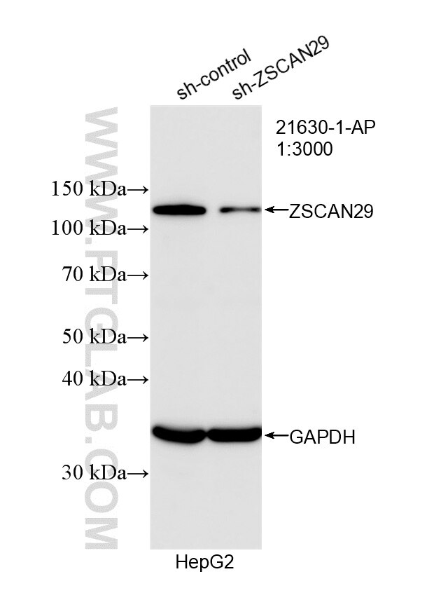 WB analysis of HepG2 using 21630-1-AP (same clone as 21630-1-PBS) Western Blot (WB) analysis of HepG2 cells using ZSCAN29 Polyclonal antibody (21630-1-AP)