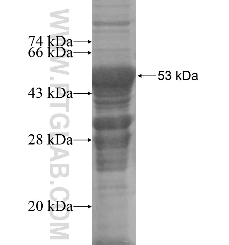 ZSCAN29 fusion protein Ag16239 SDS-PAGE
