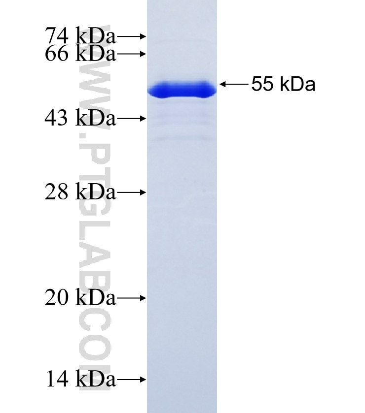 ZSCAN4 fusion protein Ag22134 SDS-PAGE ZSCAN4 fusion protein Ag22134 SDS-PAGE