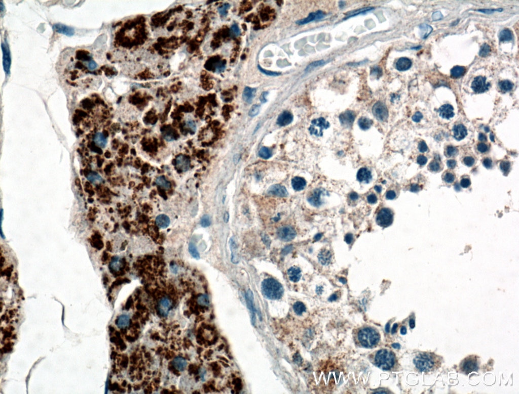 Immunohistochemistry (IHC) staining of human testis tissue using ZSCAN5A Polyclonal antibody (19926-1-AP)