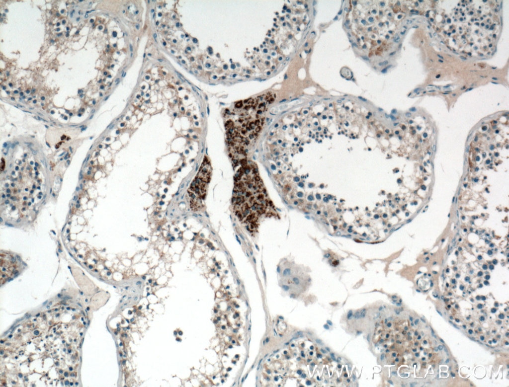 Immunohistochemistry (IHC) staining of human testis tissue using ZSCAN5A Polyclonal antibody (19926-1-AP)