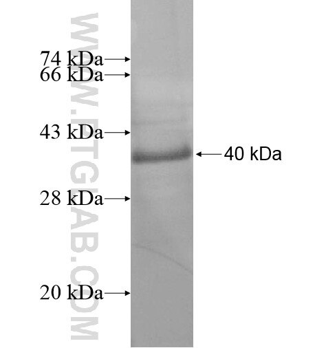 ZSCAN5A fusion protein Ag13898 SDS-PAGE