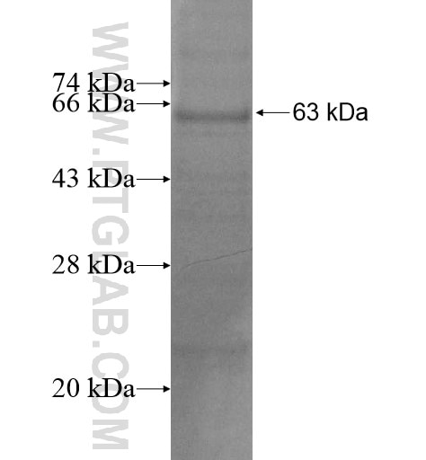 ZSWIM1 fusion protein Ag13739 SDS-PAGE
