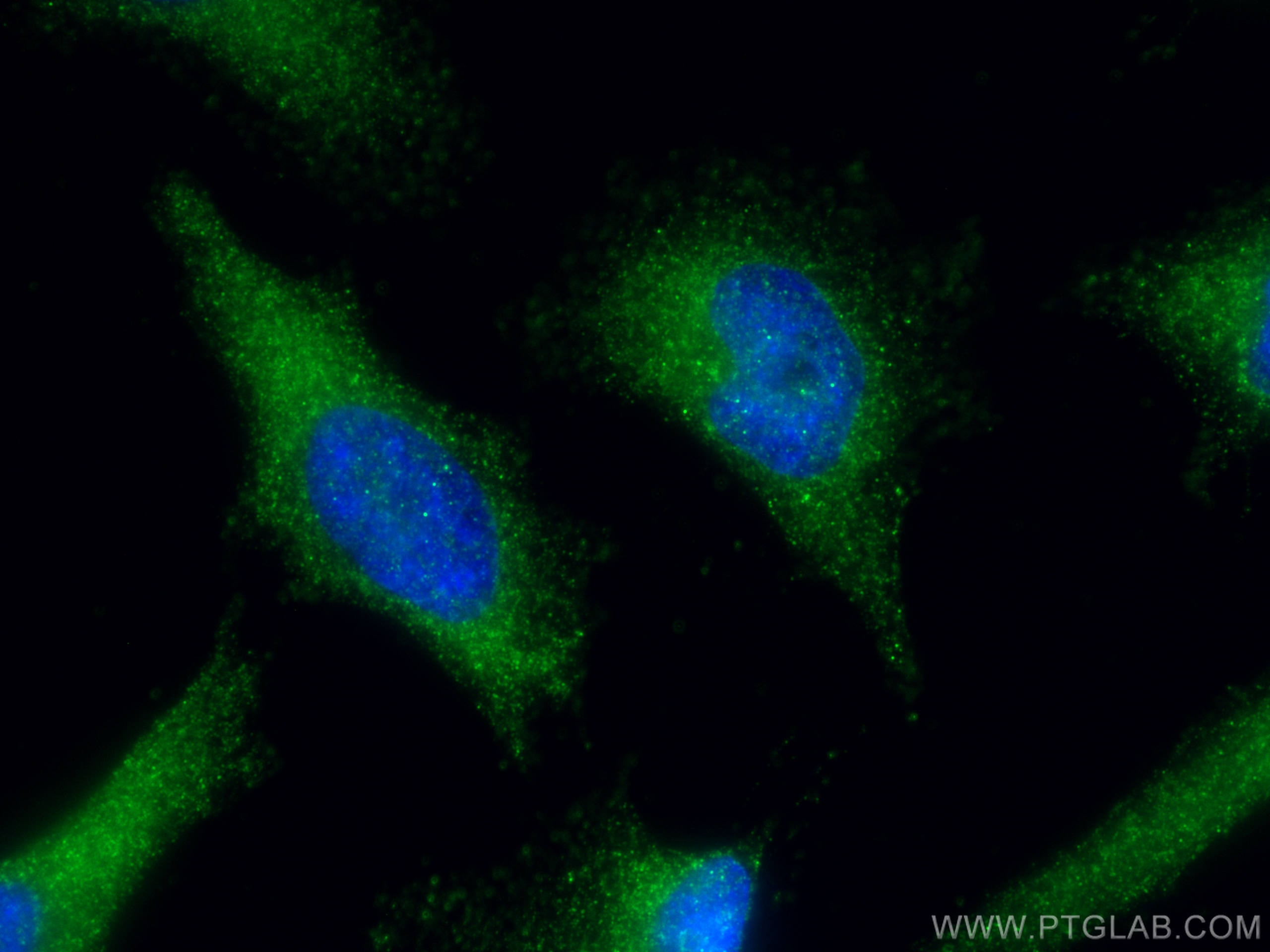 Immunofluorescence (IF) / fluorescent staining of HeLa cells using ZW10 Polyclonal antibody (24561-1-AP)