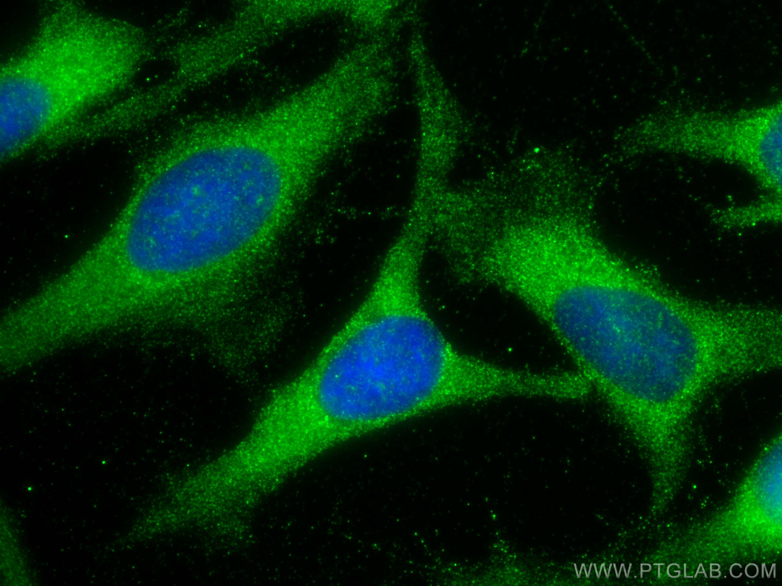 Immunofluorescence (IF) / fluorescent staining of HeLa cells using ZW10 Polyclonal antibody (24561-1-AP)