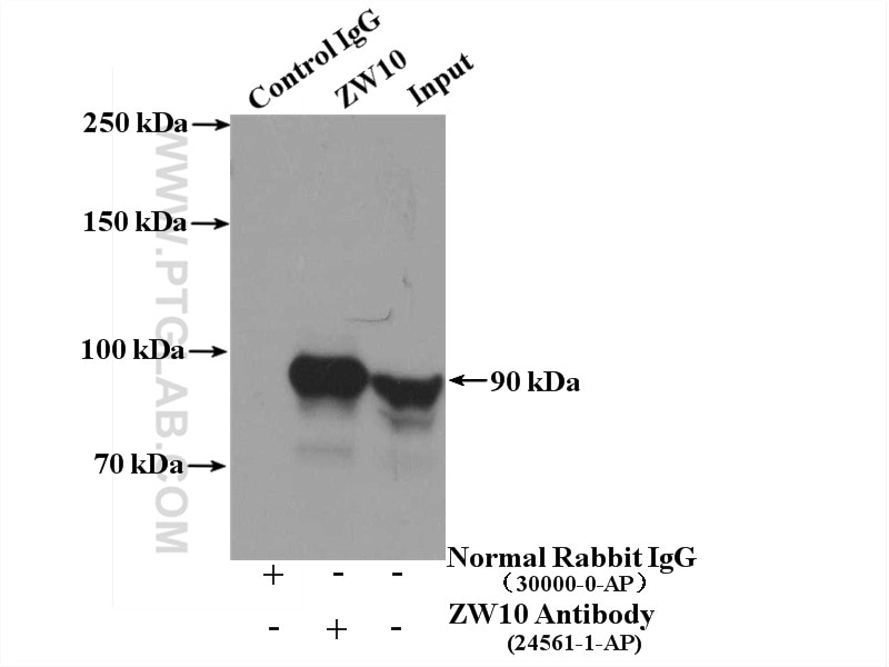 Immunoprecipitation (IP) experiment of Jurkat cells using ZW10 Polyclonal antibody (24561-1-AP)
