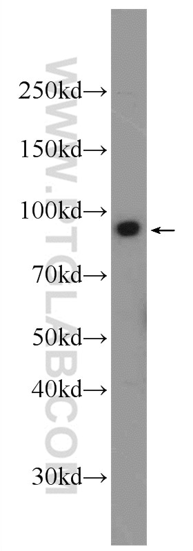 Western Blot (WB) analysis of HeLa cells using ZW10 Polyclonal antibody (24561-1-AP)