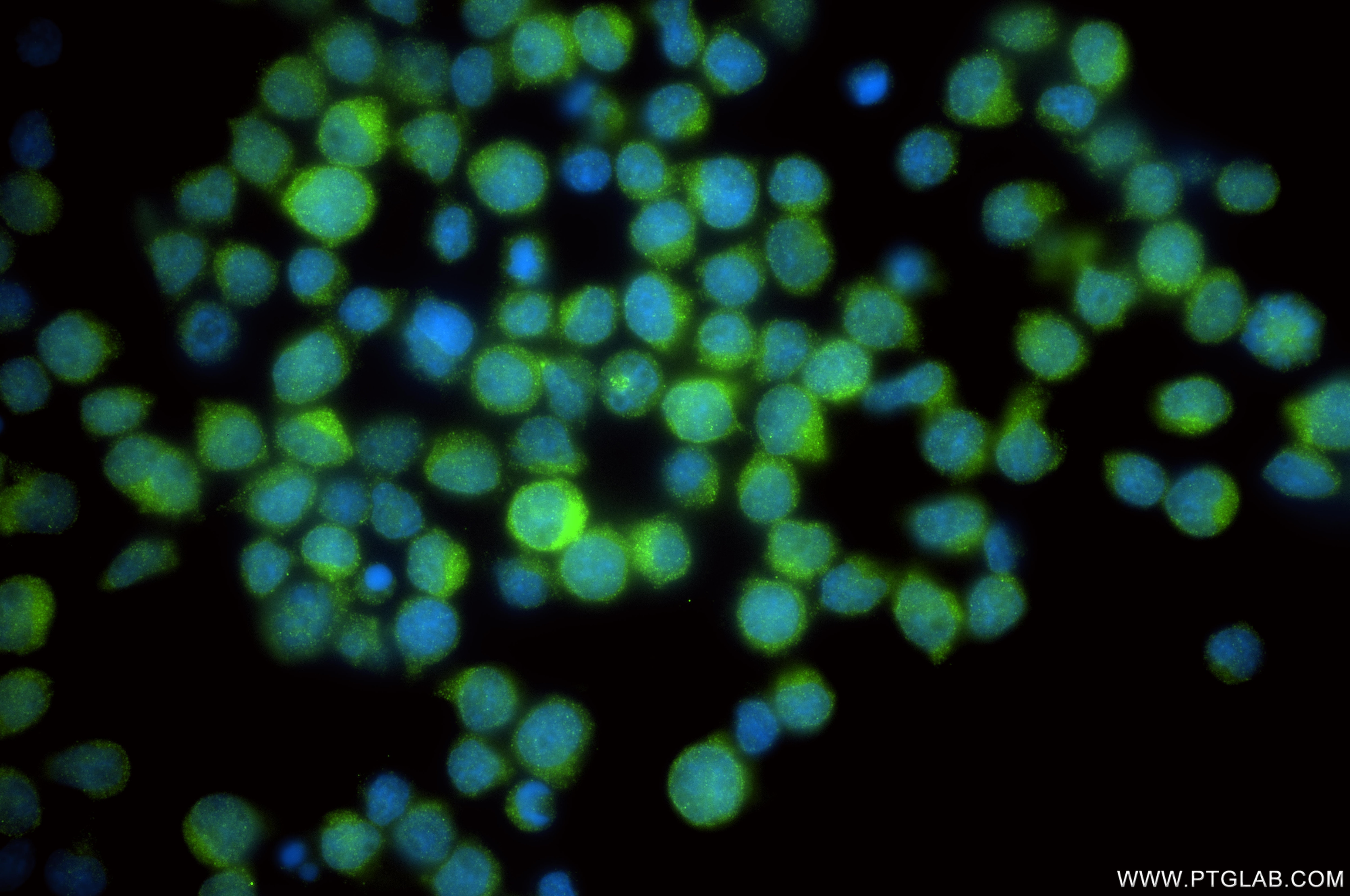 IF Staining of Jurkat using 86726-1-RR Immunofluorescence (IF) / fluorescent staining of Jurkat cells using ZW10 Recombinant monoclonal antibody (86726-1-RR)