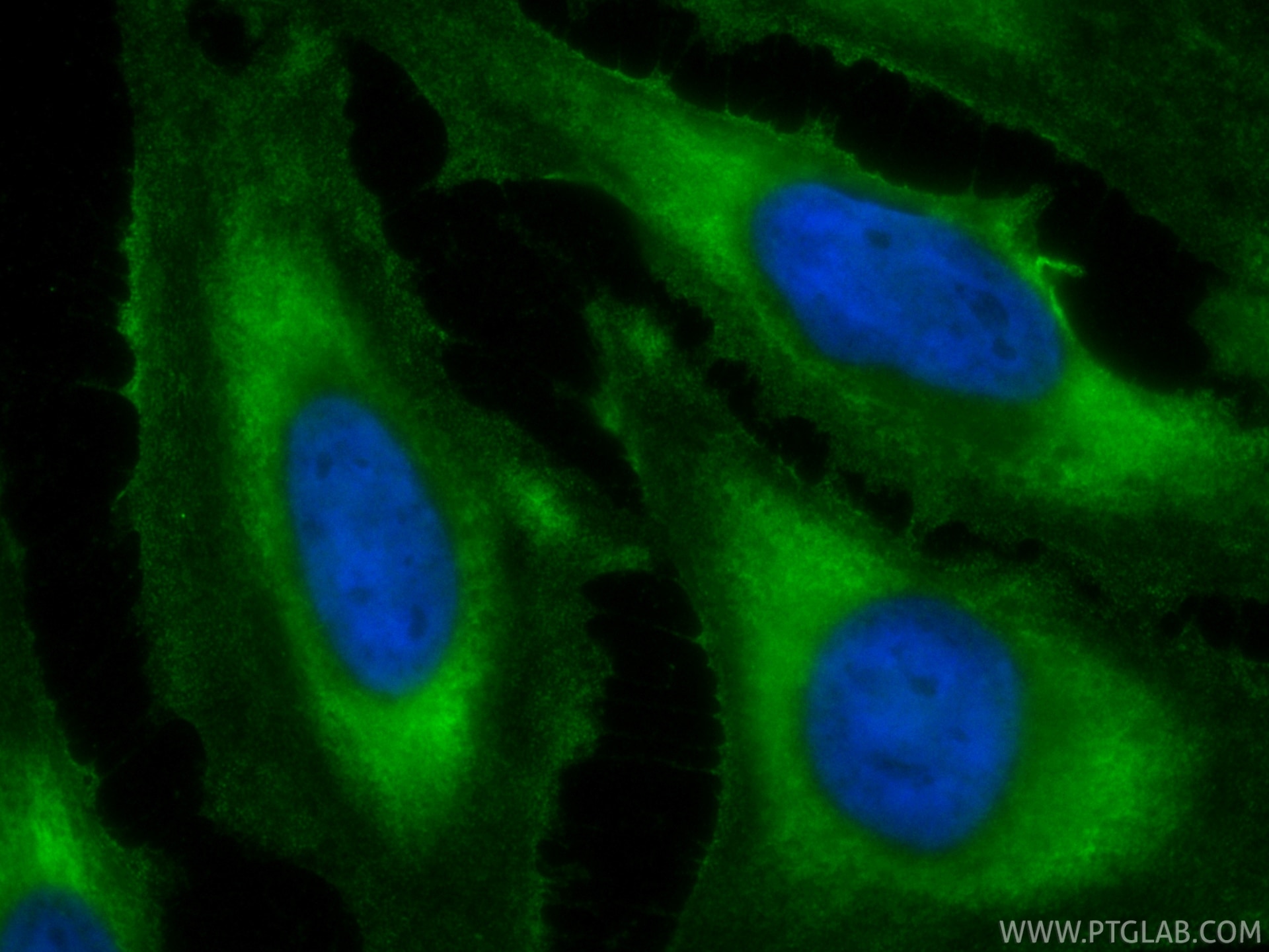 IF Staining of HeLa using CL488-86726 Immunofluorescence (IF) / fluorescent staining of HeLa cells using CoraLite® Plus 488-conjugated ZW10 Recombinant mon (CL488-86726)