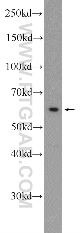 Western Blot (WB) analysis of PC-3 cells using ZWILCH Polyclonal antibody (14281-1-AP)