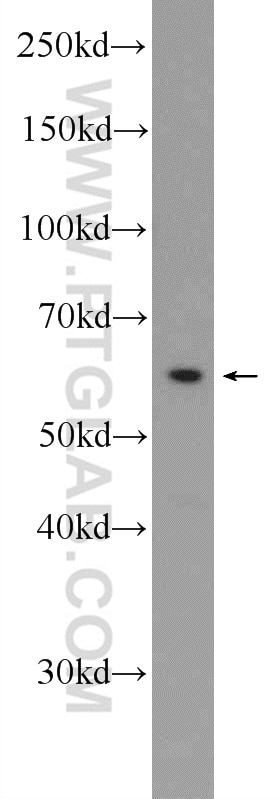 WB analysis of PC-3 using 14281-1-AP