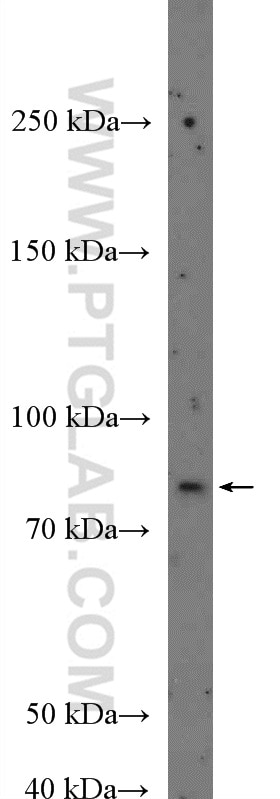 Western Blot (WB) analysis of A431 cells using ZXDA Polyclonal antibody (26261-1-AP)