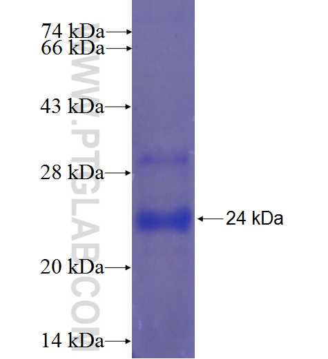 ZXDA fusion protein Ag23411 SDS-PAGE