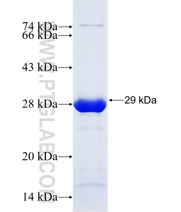 ZXDB fusion protein Ag36956 SDS-PAGE ZXDB fusion protein Ag36956 SDS-PAGE