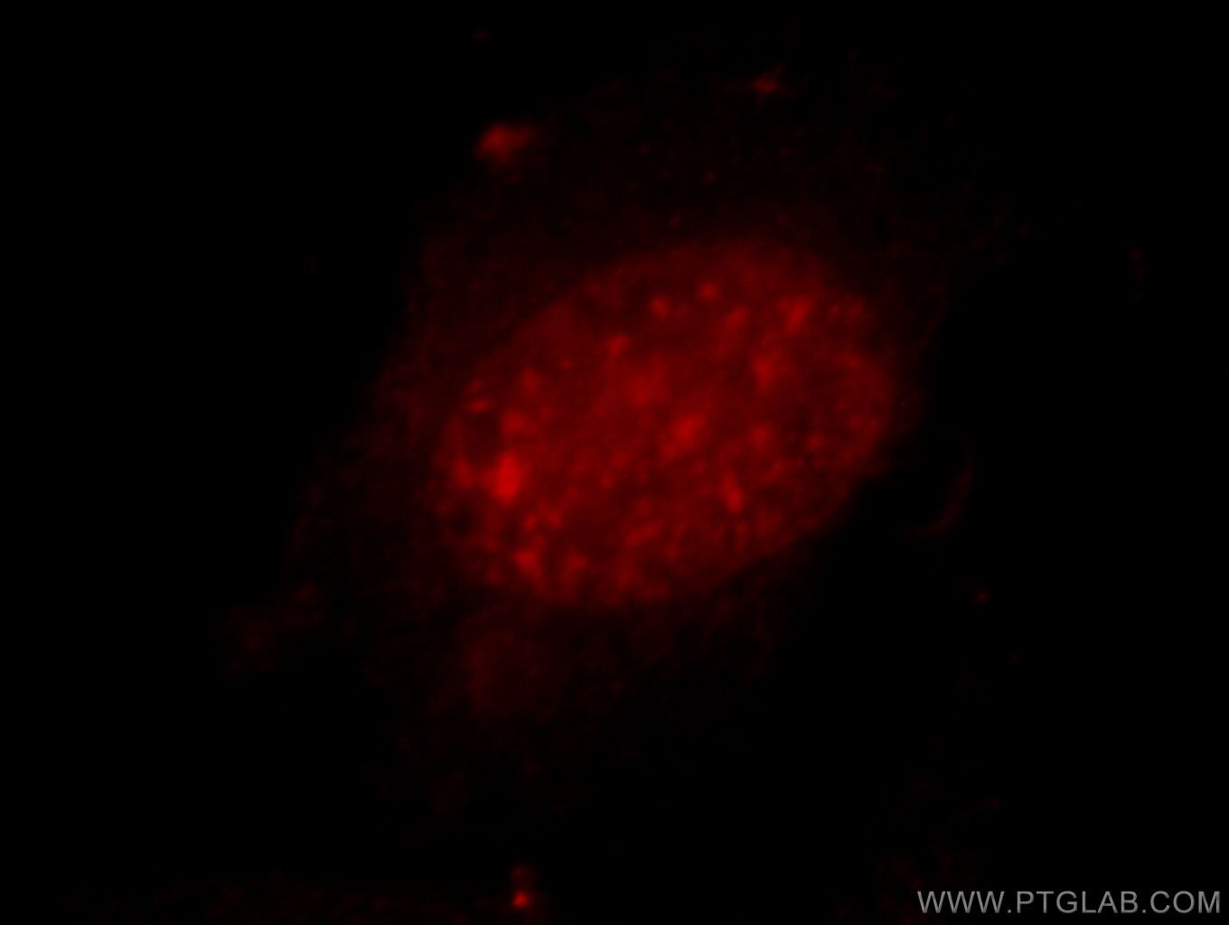 Immunofluorescence (IF) / fluorescent staining of HeLa cells using ZXDC Polyclonal antibody (20530-1-AP)