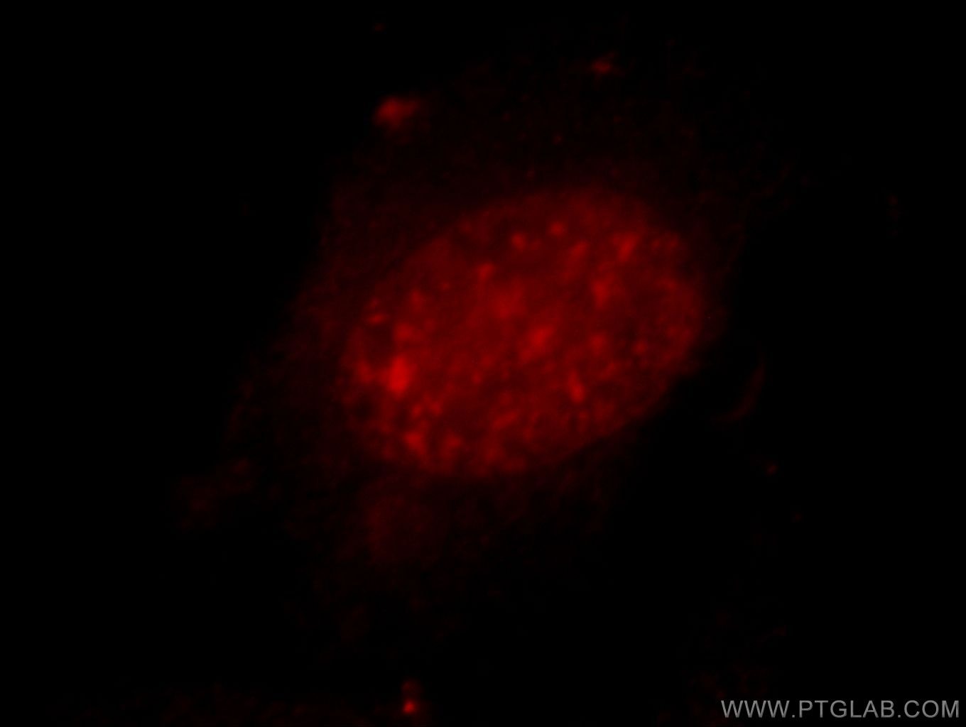 IF Staining of HeLa using 20530-1-AP