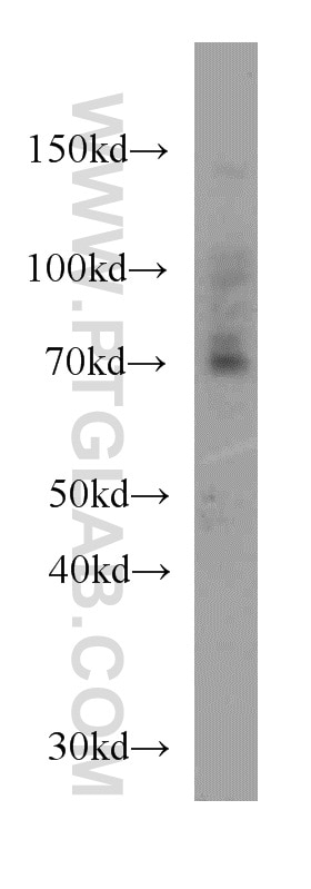 Western Blot (WB) analysis of mouse kidney tissue using ZXDC Polyclonal antibody (20530-1-AP)