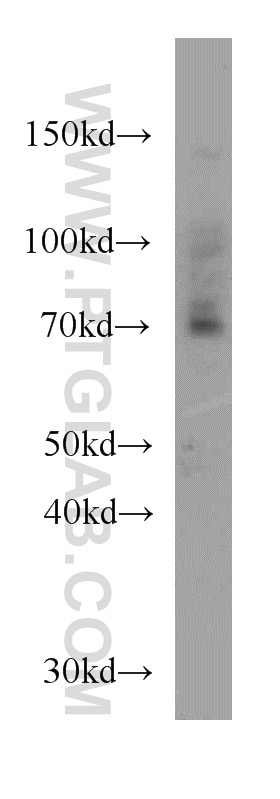 WB analysis of mouse kidney using 20530-1-AP