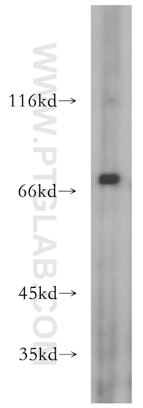 Western Blot (WB) analysis of HEK-293 cells using ZXDC Polyclonal antibody (20530-1-AP)