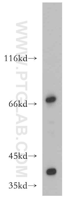 Western Blot (WB) analysis of A431 cells using ZXDC Polyclonal antibody (20530-1-AP)