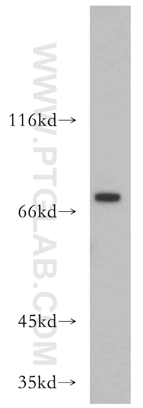 Western Blot (WB) analysis of human kidney tissue using ZXDC Polyclonal antibody (20530-1-AP)