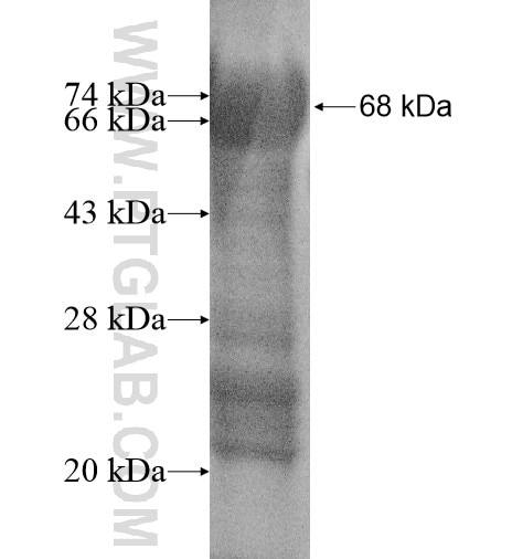 ZXDC fusion protein Ag14392 SDS-PAGE