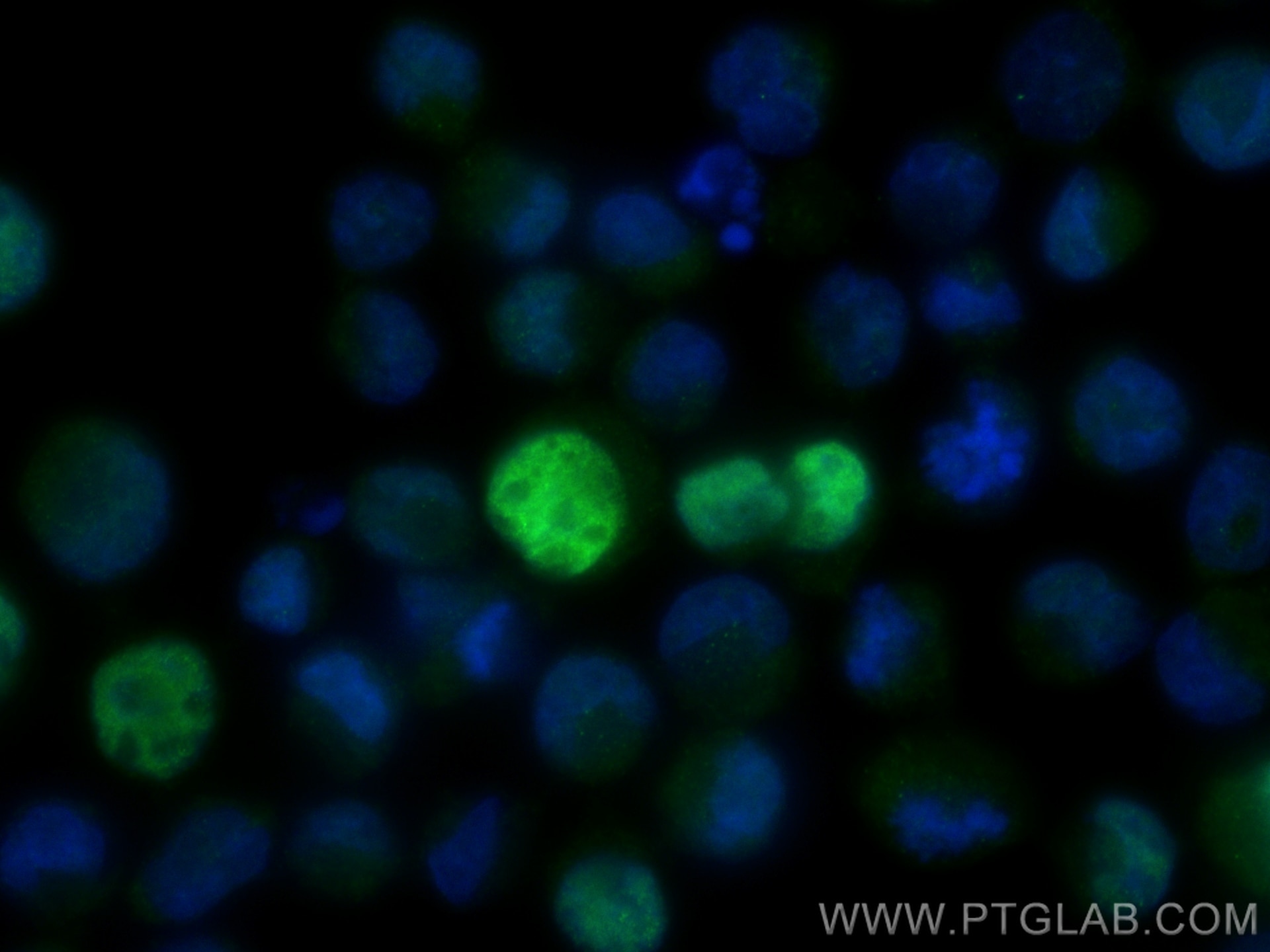 Immunofluorescence (IF) / fluorescent staining of K-562 cells using ZYG11A Polyclonal antibody (30597-1-AP)