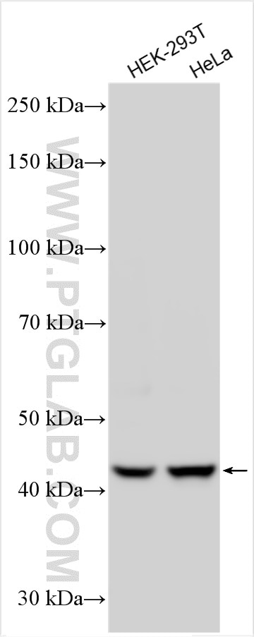 Western Blot (WB) analysis of various lysates using ZYG11A Polyclonal antibody (30597-1-AP)