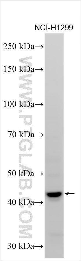 Western Blot (WB) analysis of various lysates using ZYG11A Polyclonal antibody (30597-1-AP)