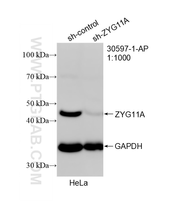 Western Blot (WB) analysis of HeLa cells using ZYG11A Polyclonal antibody (30597-1-AP)