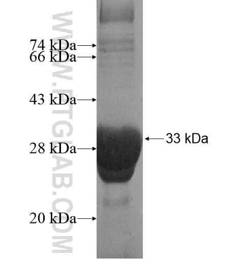 ZYG11B fusion protein Ag15036 SDS-PAGE