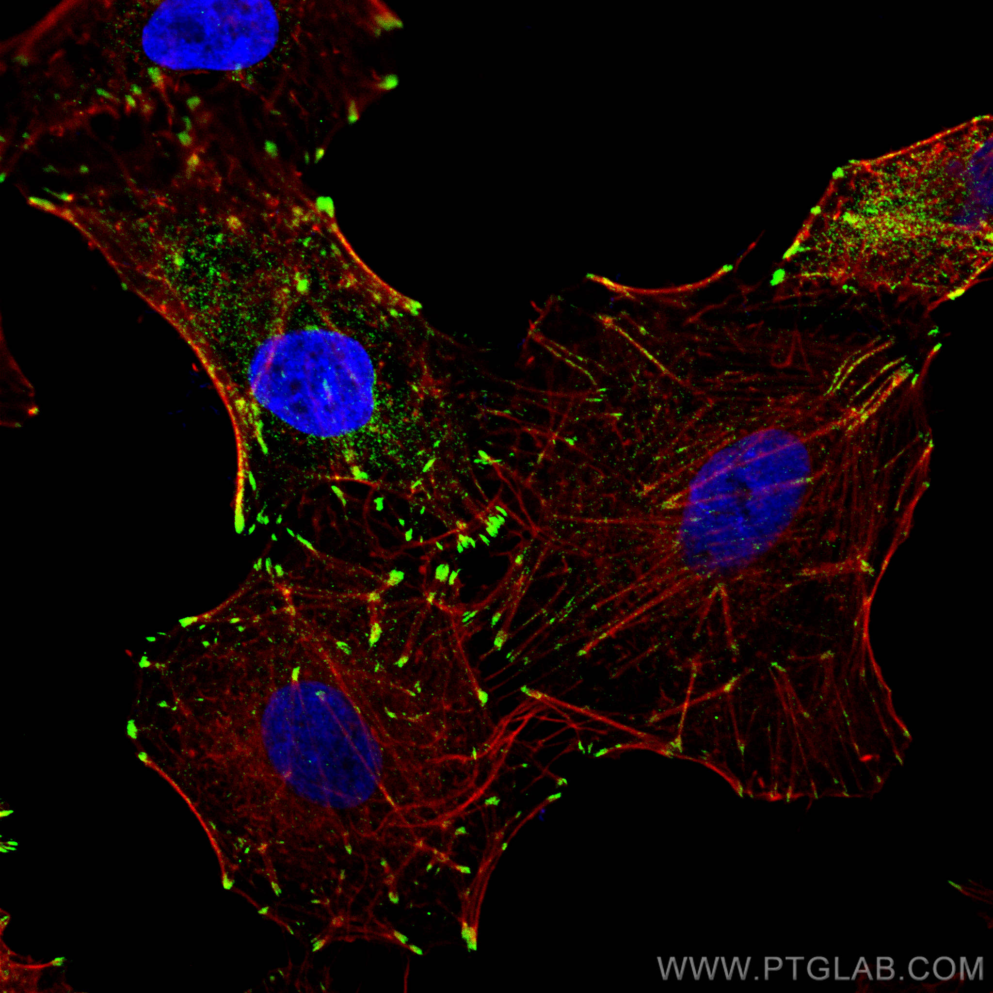 Immunofluorescence (IF) / fluorescent staining of A549 cells using Zyxin Polyclonal antibody (10330-1-AP)