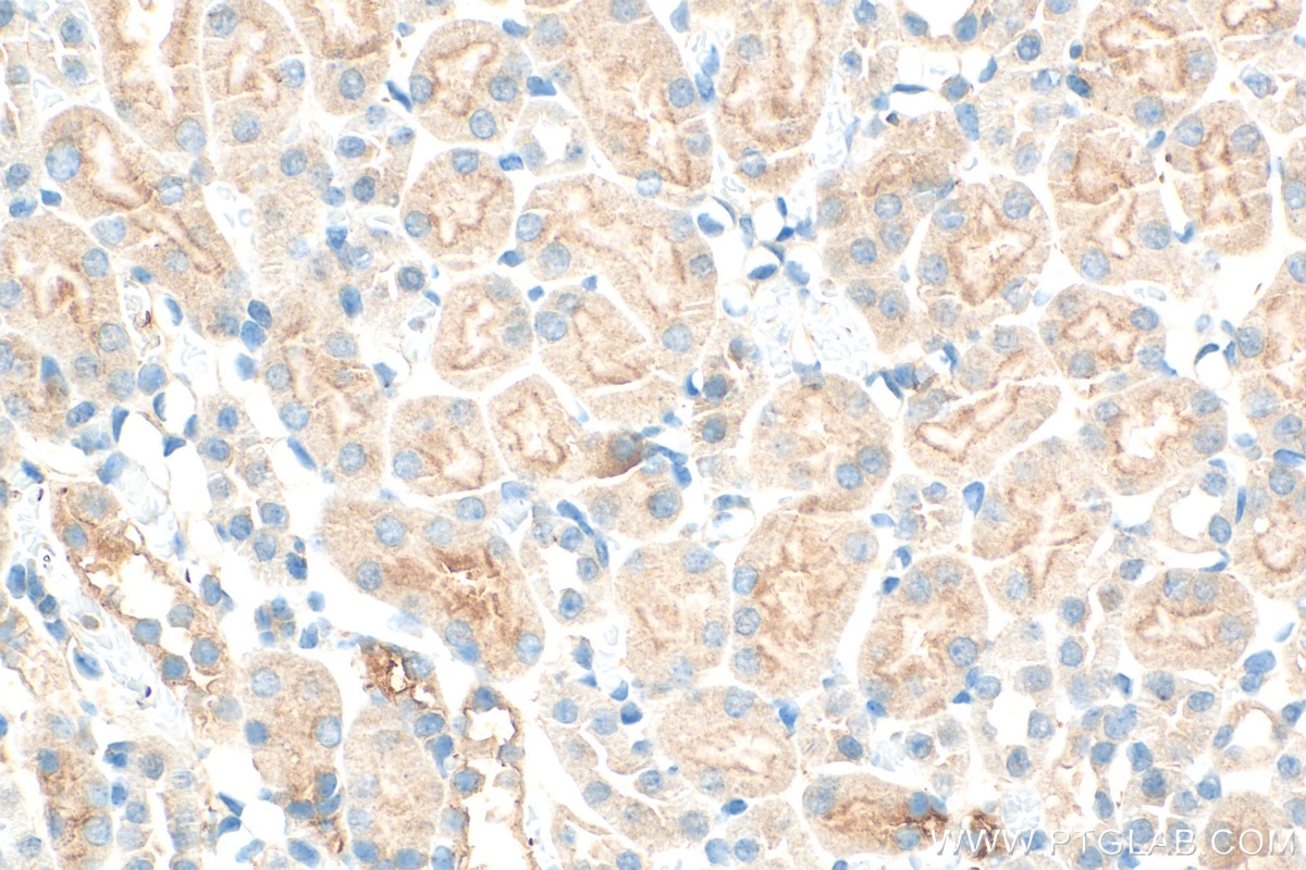 Immunohistochemistry (IHC) staining of mouse kidney tissue using Zyxin Polyclonal antibody (10330-1-AP)
