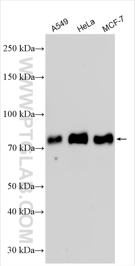 Western Blot (WB) analysis of various lysates using Zyxin Polyclonal antibody (10330-1-AP)