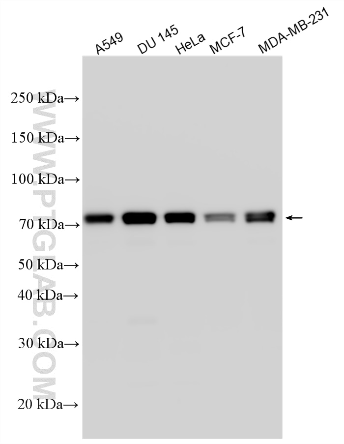 Western Blot (WB) analysis of various lysates using Zyxin Polyclonal antibody (10330-1-AP)