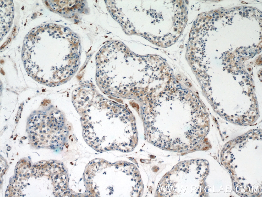 Immunohistochemistry (IHC) staining of human testis tissue using Zyxin Monoclonal antibody (60254-1-Ig)