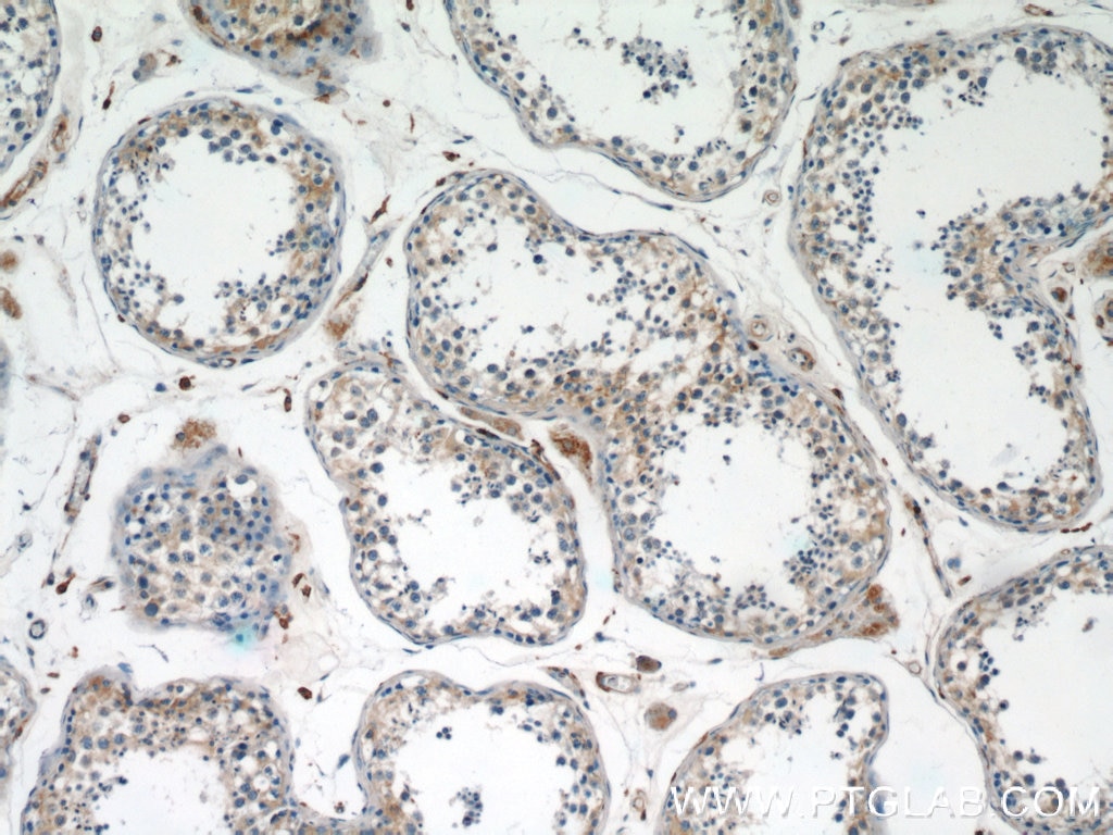 IHC staining of human testis using 60254-1-Ig