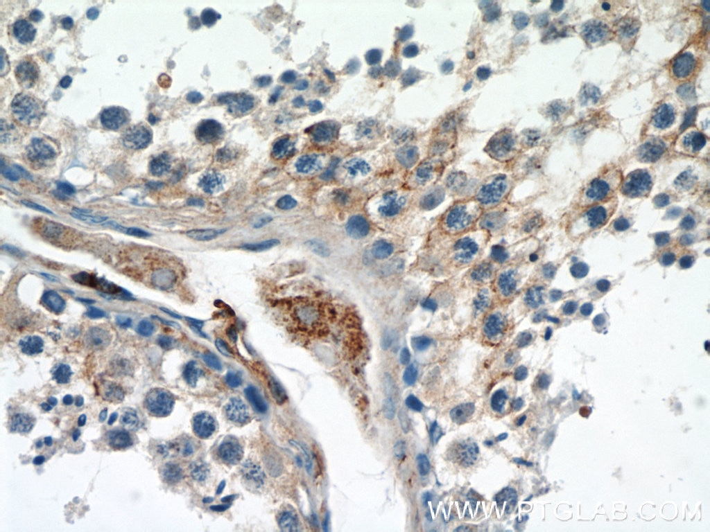 Immunohistochemistry (IHC) staining of human testis tissue using Zyxin Monoclonal antibody (60254-1-Ig)