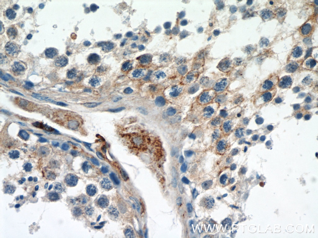 IHC staining of human testis using 60254-1-Ig