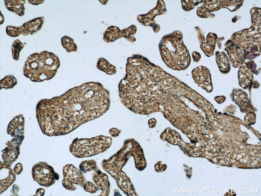 Immunohistochemistry (IHC) staining of human placenta tissue using Zyxin Monoclonal antibody (60254-1-Ig)
