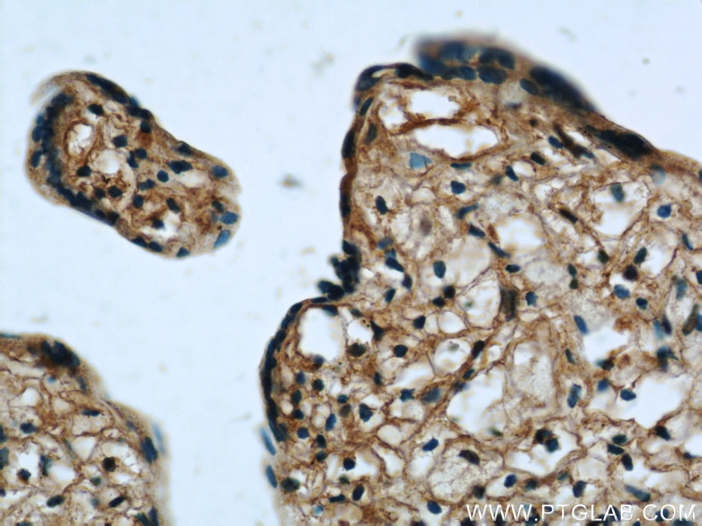 Immunohistochemistry (IHC) staining of human placenta tissue using Zyxin Monoclonal antibody (60254-1-Ig)