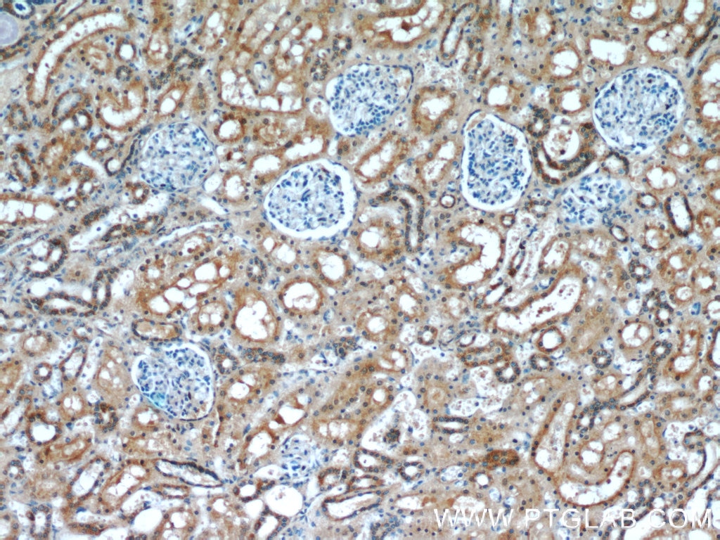 Immunohistochemistry (IHC) staining of human kidney tissue using Zyxin Monoclonal antibody (60254-1-Ig)