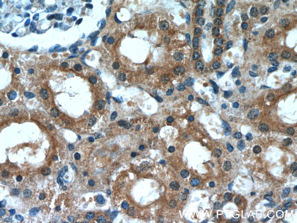 Immunohistochemistry (IHC) staining of human kidney tissue using Zyxin Monoclonal antibody (60254-1-Ig)